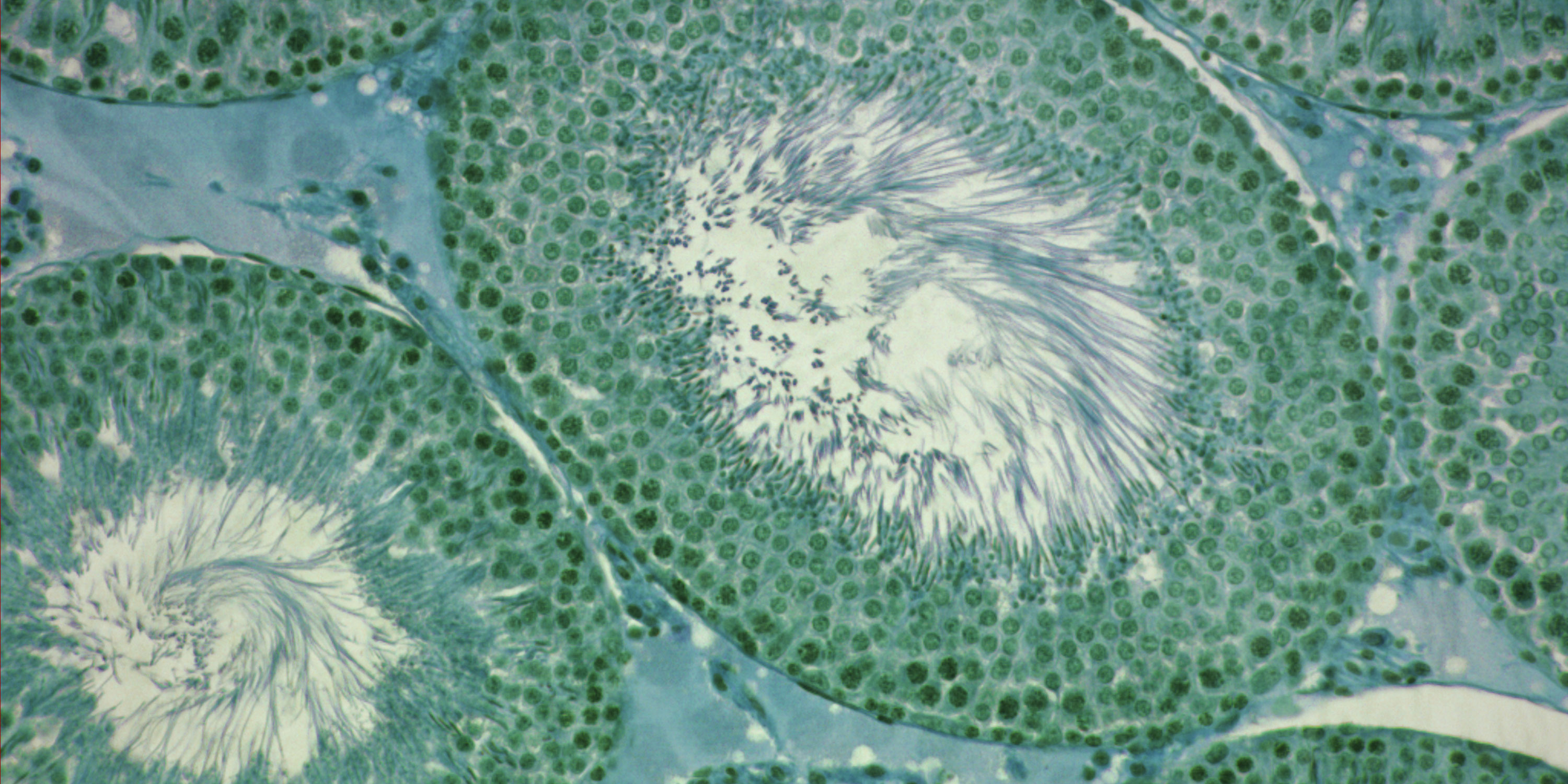 Microscope image of a rat’s testicles. This forms part of DTU’s research into the damaging effects of endocrine disrupters. And studies of how even small doses can have significant adverse effects if they occur in a cocktail of chemicals.